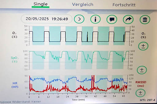 IHHT 3 IHHT Behandlung mit HRV-Messung